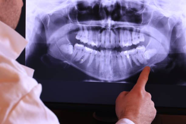 Best Emergency Denture Repair in Niles, OH